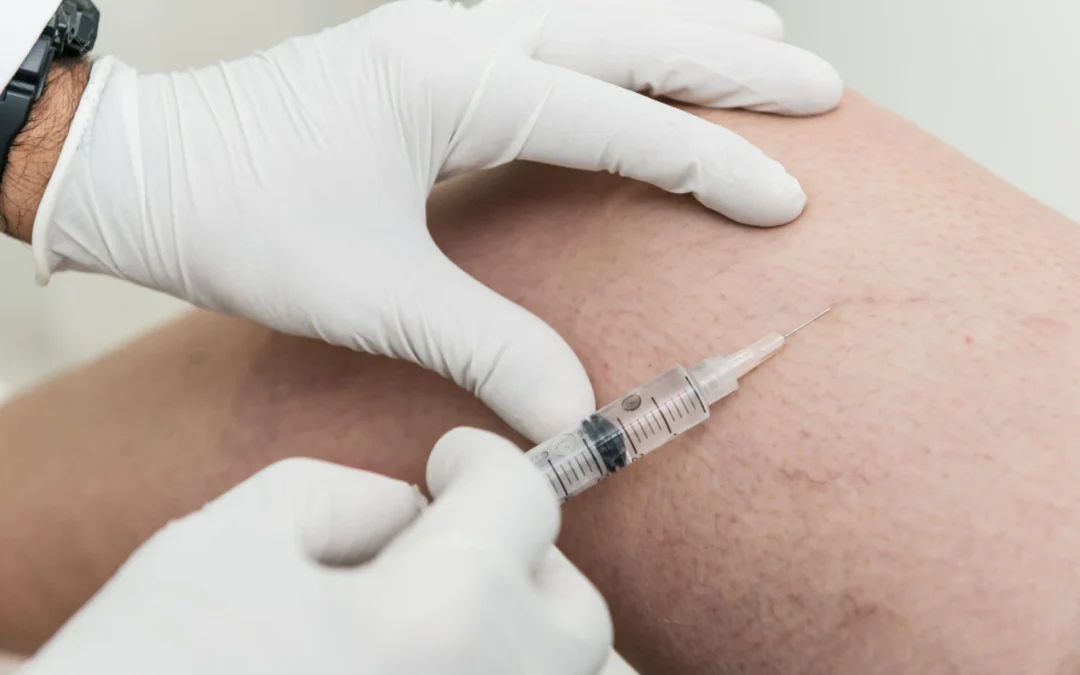 Escleroterapia: conheça o procedimento para tratar vasinhos e pequenas varizes